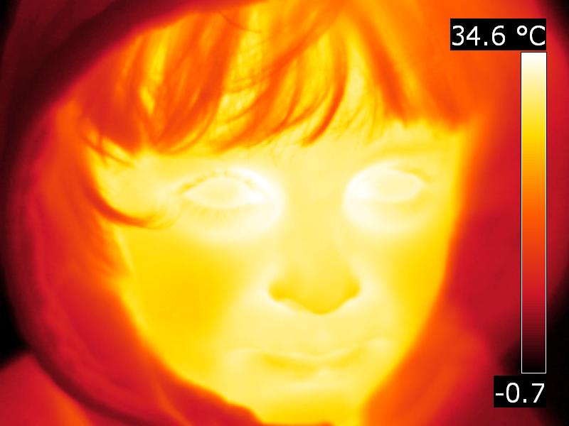 Face thermogram