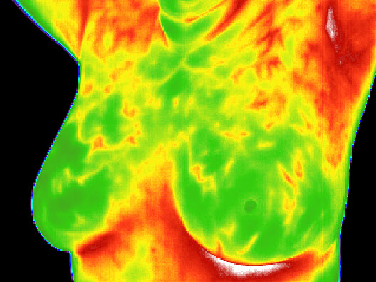 Medical thermography